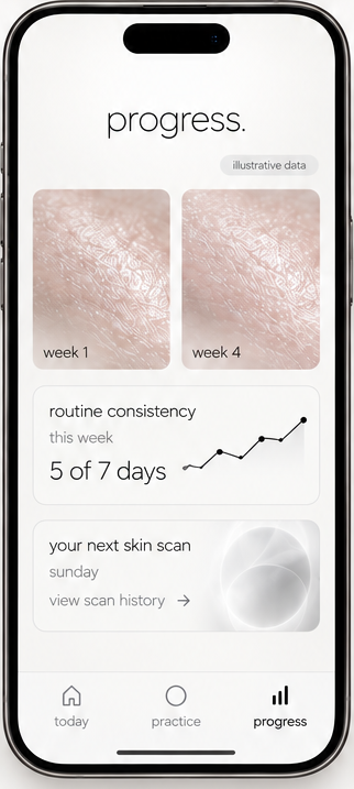 App screen: progress tracking with week one and week four skin photos and routine consistency.